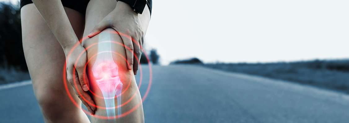 Knieschmerzen Läufer mit 3D Darstellung der Knochen