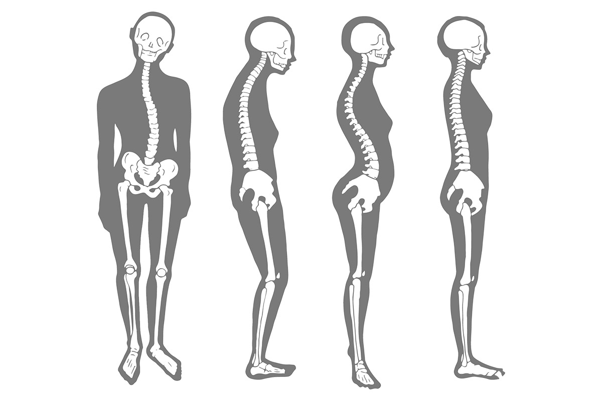 skelett zeigt körperhaltungen