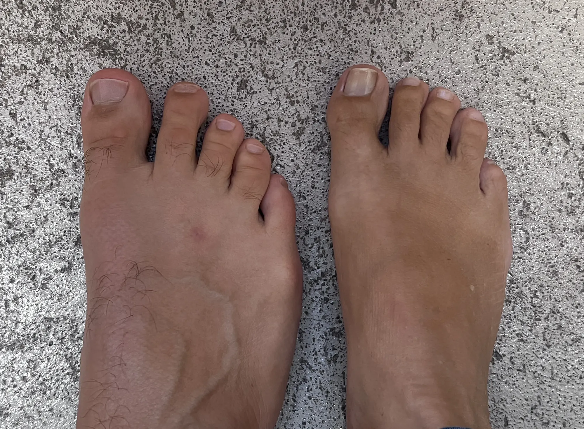 Schmaler Fuß und breiter Fuß nebeneinander